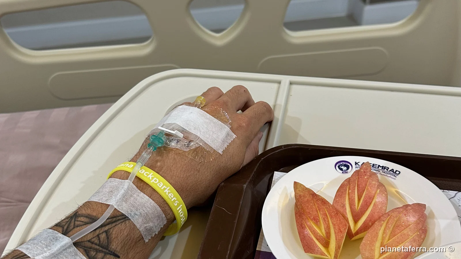 Il braccio di Luca con la flebo e il braccialetto del ricovero al Kasemrad International Hospital di Vientiane, nel 2023
